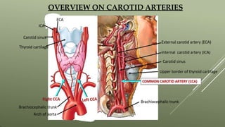 OVERVIEW ON CAROTID ARTERIES
 
