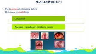 Barry Defect MAXILLARY DEFECTS CLASSIFICATIONS & DIFFERENT PROSTHETIC ...