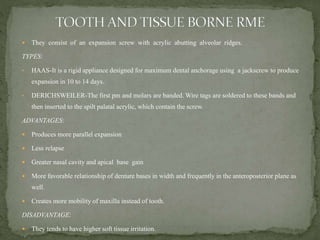  They consist of an expansion screw with acrylic abutting alveolar ridges.
TYPES:
• HAAS-It is a rigid appliance designed for maximum dental anchorage using a jackscrew to produce
expansion in 10 to 14 days.
• DERICHSWEILER-The first pm and molars are banded. Wire tags are soldered to these bands and
then inserted to the spilt palatal acrylic, which contain the screw.
ADVANTAGES:
 Produces more parallel expansion
 Less relapse
 Greater nasal cavity and apical base gain
 More favorable relationship of denture bases in width and frequently in the anteroposterior plane as
well.
 Creates more mobility of maxilla instead of tooth.
DISADVANTAGE:
 They tends to have higher soft tissue irritation.
 