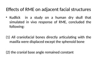 Face Mask Rme maxillary expansion clinical implication.pptx