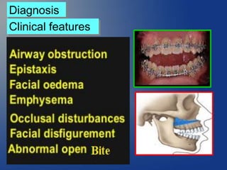 Clinical features
Diagnosis
 