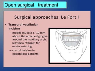 Open surgical treatment
 