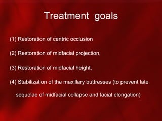 Maxillary fractures presentation ih | PPT