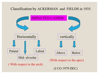 Maxillary impacted canine management | PPTX