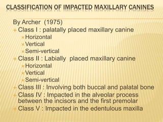Maxillary impactions