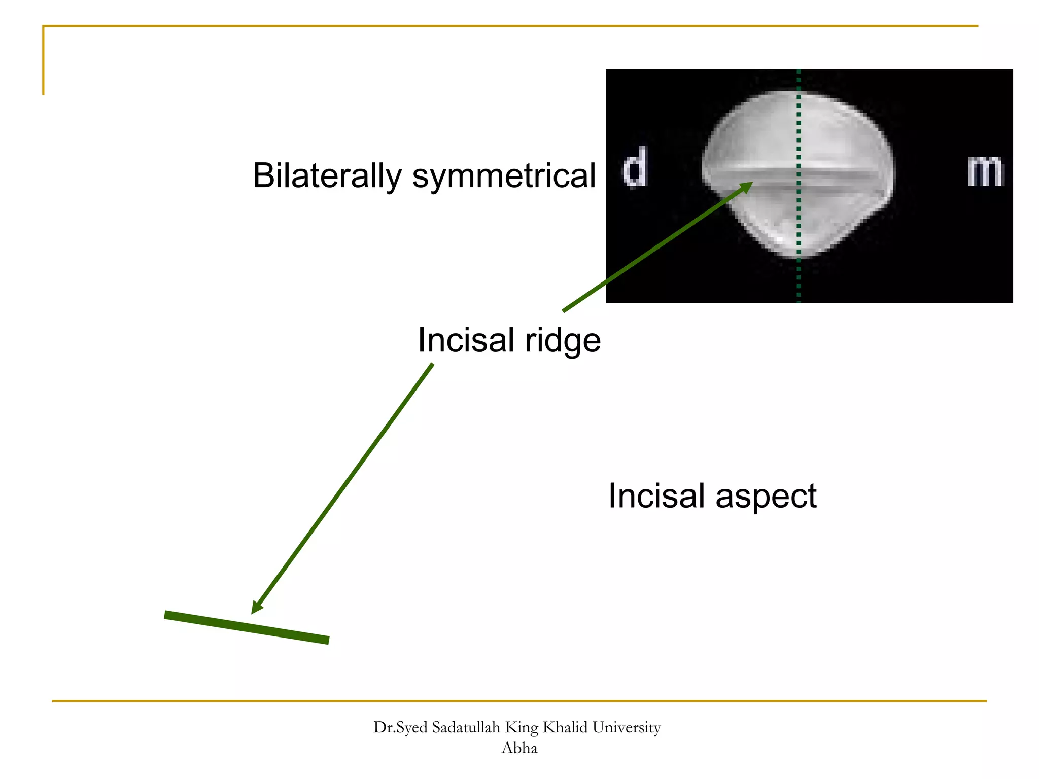 morphology of Maxillary central and lateral incisors teeth | PPT
