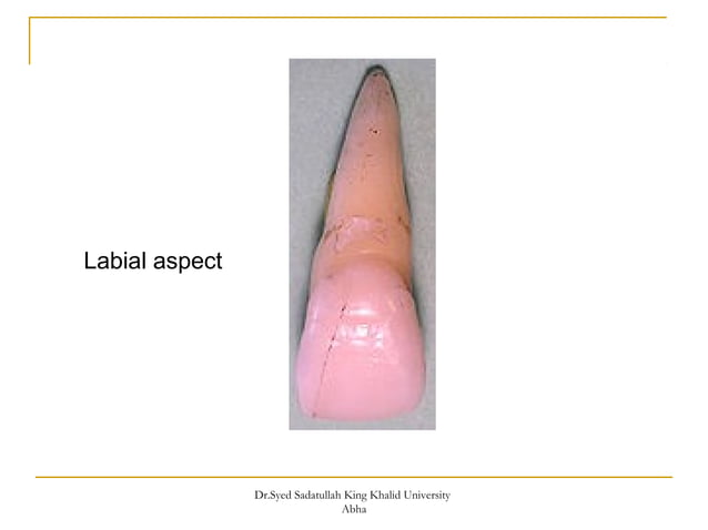morphology of Maxillary central and lateral incisors teeth | PPT ...