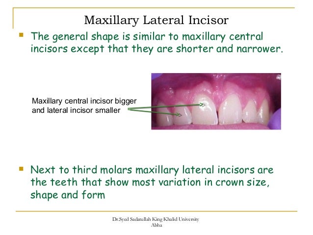 morphology of maxillary central and lateral incisors teeth average size of organ