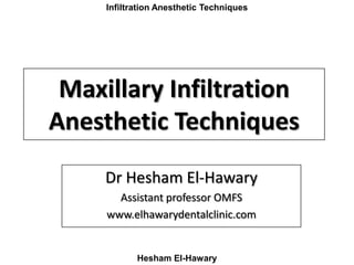 Maxillay Infiltration Anesthetic Techniques
Hesham El-Hawary
‫االيه‬ ‫الزمر‬ ‫﴿سورة‬ ٣٨ ﴾
 