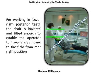 Maxillay Infiltration Anesthetic Techniques
Hesham El-Hawary
For working in lower
right posterior teeth
the chair is lower...