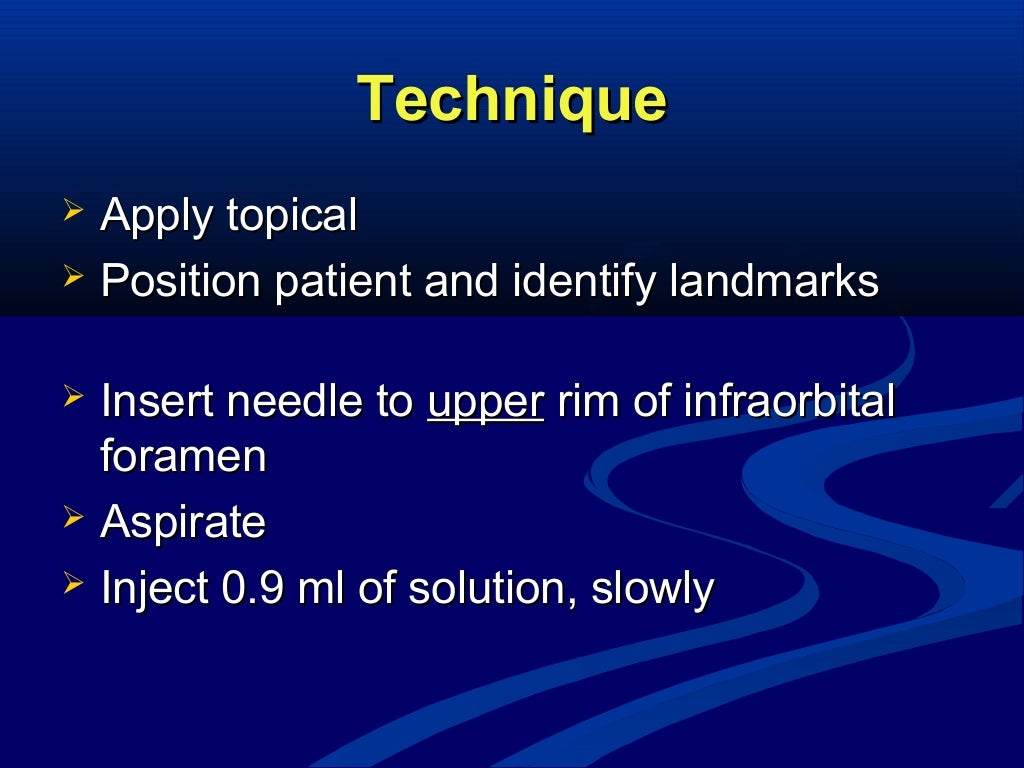 Maxillary Local Anesthesia
