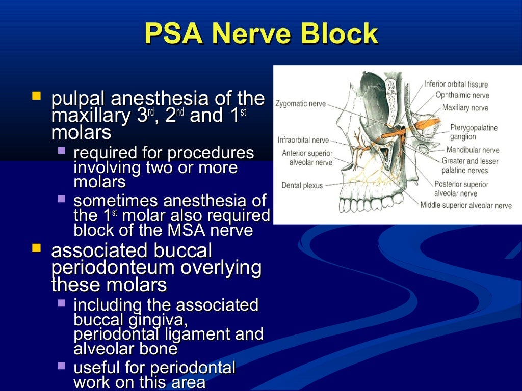 Maxillary Local Anesthesia