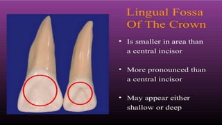 LINGUAL ASPECT 
• CROWN IS TRAPEZOIDAL 
• MARGINAL RIDGES ARE 
MARKED 
• LINGUOINCISAL RIDGE IS WELL-DEVELOPED 
AND MORE 
CONCAVE LINGUAL FOSSA 
 