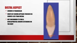 DISTAL ASPECT 
• CROWN IS TRIANGULAR 
• WIDTH OF CROWN APPEARS THICKER CEJ 
CURVES LESS THAN MESIAL 
• NOT UNCOMMON TO FIND A 
DEVELOPMENTAL GROOVE EXTENDING ON 
THE ROOT 
 