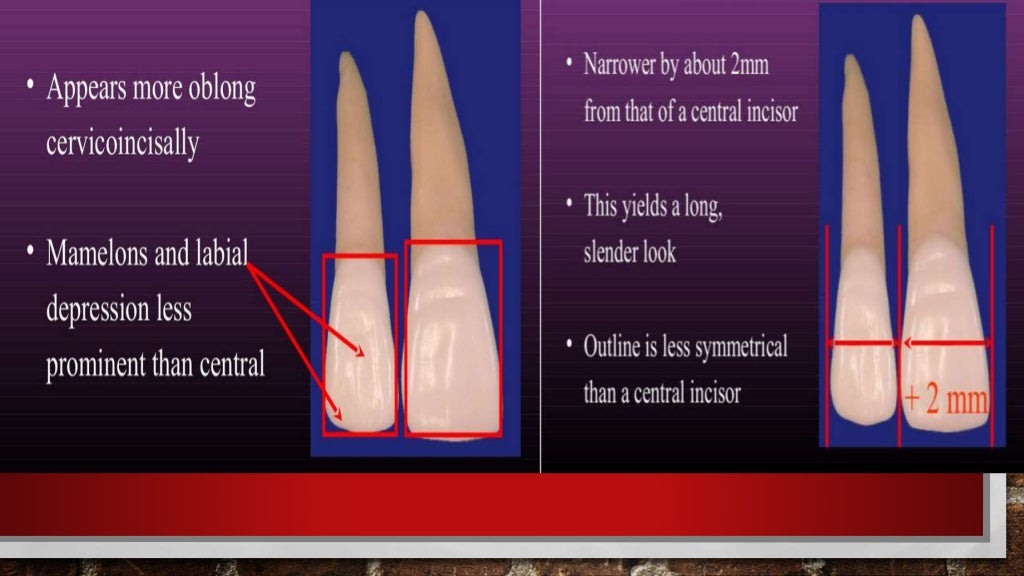 PERMANENT MAXILLARY LATERAL INCISOR