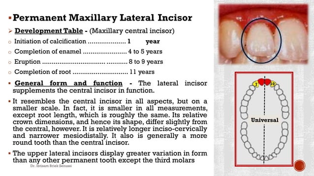 Maxillary lateral incisor. | PDF | Dental Health | Diseases and Conditions