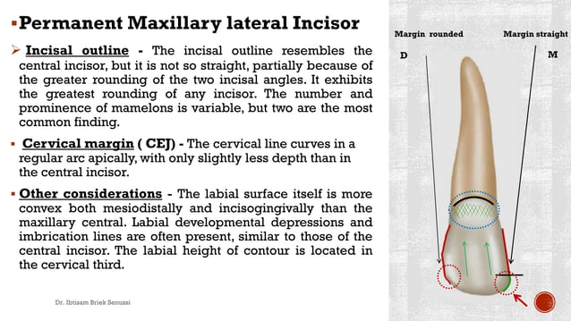 Maxillary lateral incisor. | PDF | Dental Health | Diseases and Conditions
