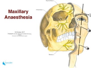 Maxillary
Anaesthesia
19 October 2017
I.Kassem,BDS,MSc,MFDS RCS Ed,MOMS RCPS Glasg,
FDSRCS
Consultant Oral & Maxillofacial surgeon
 