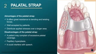 Maxillary major connectors by mohammed hekma | PPTX