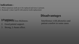 Indications:-
1.When numerous teeth are to be replaced and torus is present.
2. Kennedy’s class I and II with anterior tooth replacement
Advantages:-
1. Rigid with less thickness.
2. Good palatal support.
3. Strong, L-beam effect.
Disadvantages
Interference with phonetics and
patient comfort in some cases
 