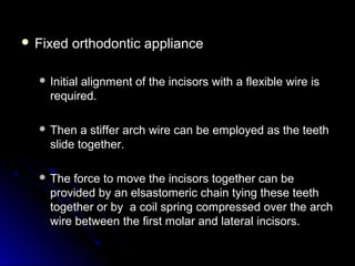  Fixed orthodontic applianceFixed orthodontic appliance
 Initial alignment of the incisors with a flexible wire isInitial alignment of the incisors with a flexible wire is
required.required.
 Then a stiffer arch wire can be employed as the teethThen a stiffer arch wire can be employed as the teeth
slide together.slide together.
 The force to move the incisors together can beThe force to move the incisors together can be
provided by an elsastomeric chain tying these teethprovided by an elsastomeric chain tying these teeth
together or by a coil spring compressed over the archtogether or by a coil spring compressed over the arch
wire between the first molar and lateral incisors.wire between the first molar and lateral incisors.
 