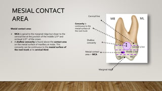 Mesial contact area:
 MCA is apical to the marginal ridge but closer to the
cervical line at the junction of the middle 1/3rd and
occlusal 1/3rd of the crown.
 A shallow concavity is found above the contact area
on the mesial surface of maxillary at molar. This
concavity can be continuous to the mesial surface of
the root trunk at its cervical third.
MESIAL CONTACT
AREA
MB ML
Cervical 1/3rd
Middle 1/3rd
Mesial contact
area = MCA
Shallow
concavity
Cervical line
Marginal ridge
MB ML
Concavity is
continuous to the
mesial surface of
the root trunk
 