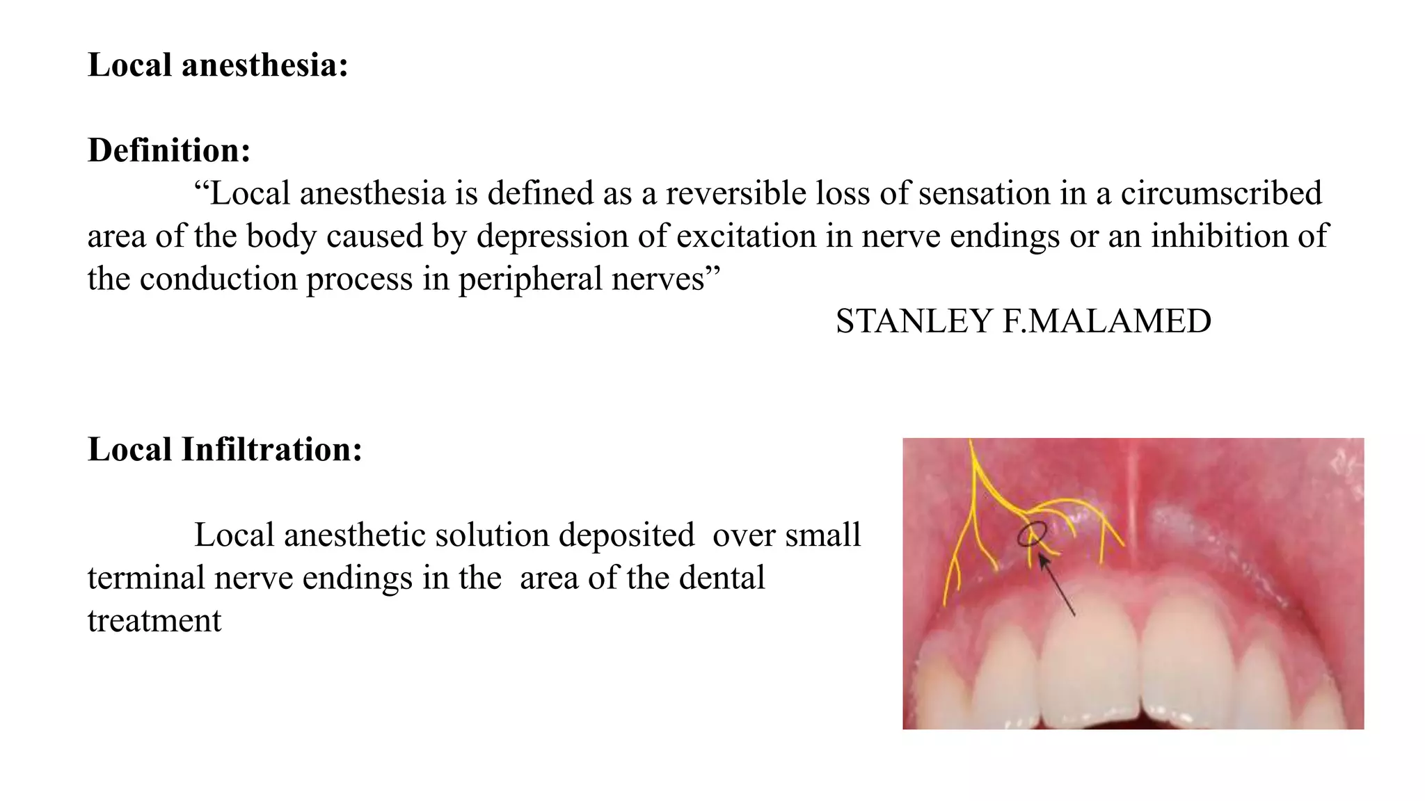 Local anesthesia:
Definition:
“Local anesthesia is defined as a reversible loss of sensation in a circumscribed
area of the body caused by depression of excitation in nerve endings or an inhibition of
the conduction process in peripheral nerves”
STANLEY F.MALAMED
Local Infiltration:
Local anesthetic solution deposited over small
terminal nerve endings in the area of the dental
treatment
 