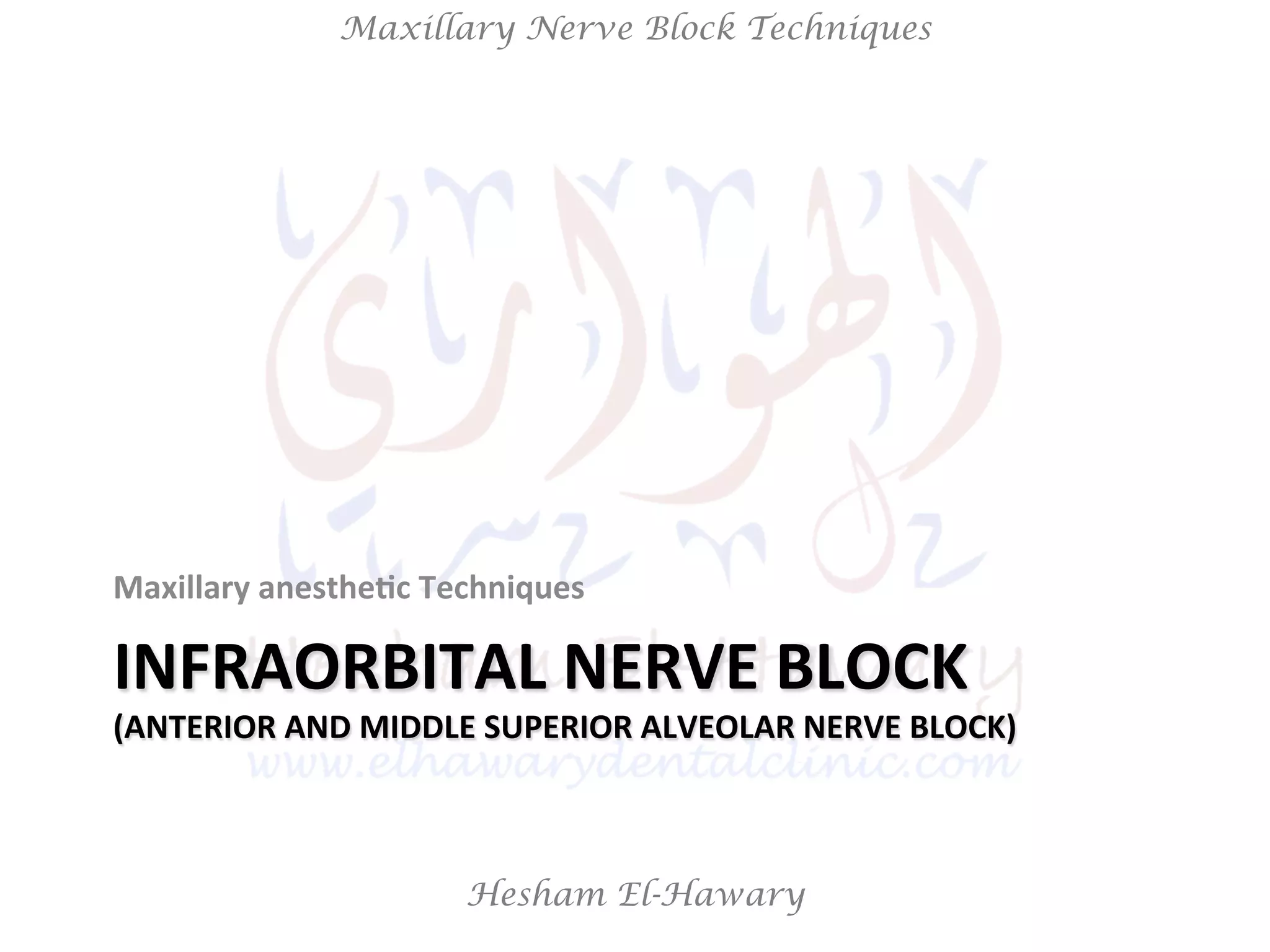 Hesham El-Hawary
Maxillary Nerve Block Techniques
INFRAORBITAL	
  NERVE	
  BLOCK	
  
(ANTERIOR	
  AND	
  MIDDLE	
  SUPERIOR	
  ALVEOLAR	
  NERVE	
  BLOCK)	
  
Maxillary	
  anesthe/c	
  Techniques	
  
 