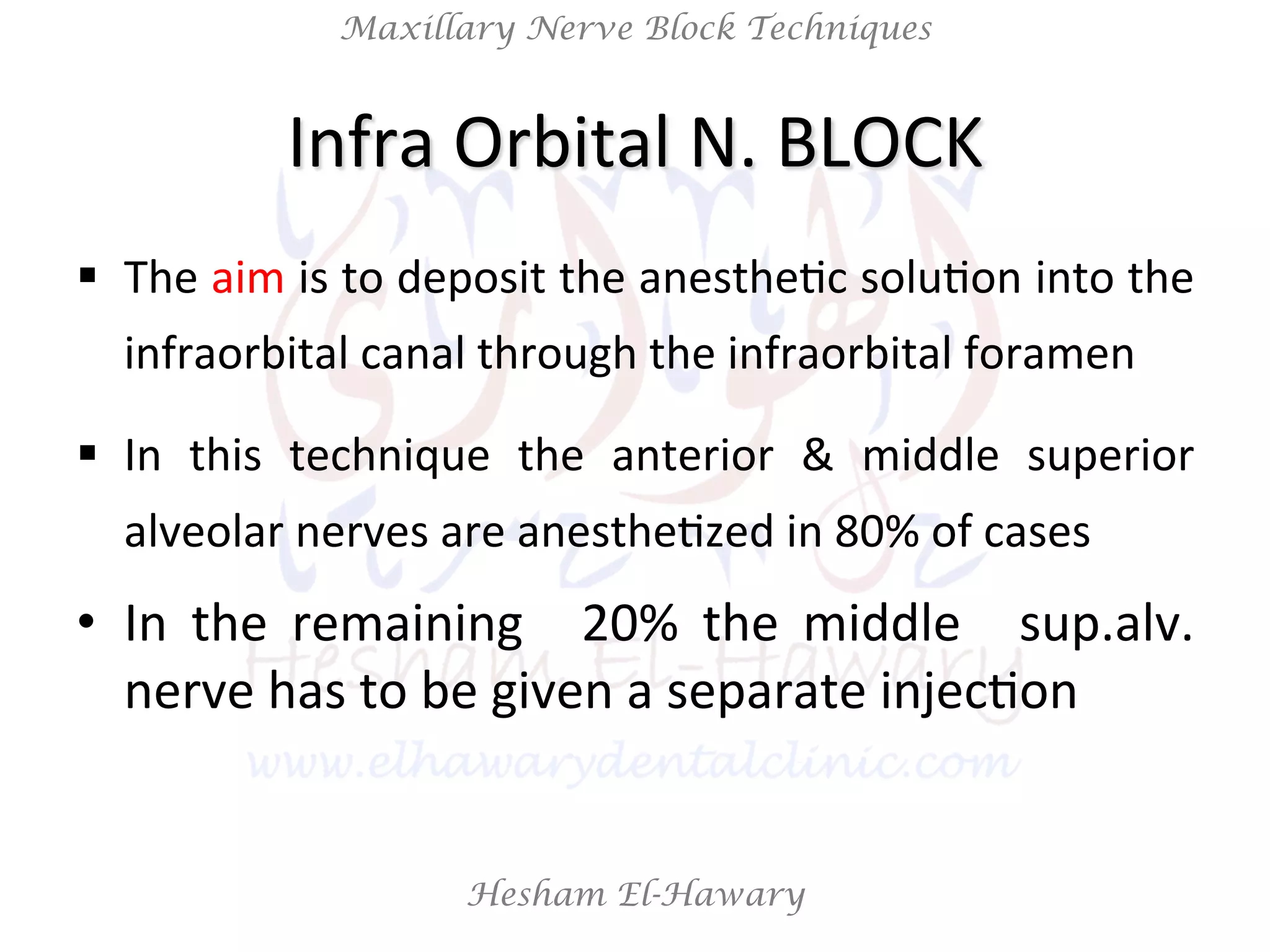 Hesham El-Hawary
Maxillary Nerve Block Techniques
Infra	
  Orbital	
  N.	
  BLOCK	
  
§  The	
  aim	
  is	
  to	
  deposit	
  the	
  anestheNc	
  soluNon	
  into	
  the	
  
infraorbital	
  canal	
  through	
  the	
  infraorbital	
  foramen	
  
§  In	
   this	
   technique	
   the	
   anterior	
   &	
   middle	
   superior	
  
alveolar	
  nerves	
  are	
  anestheNzed	
  in	
  80%	
  of	
  cases	
  
•  In	
   the	
   remaining	
   	
   20%	
   the	
   middle	
   	
   sup.alv.	
  
nerve	
  has	
  to	
  be	
  given	
  a	
  separate	
  injecNon	
  
	
  
 
