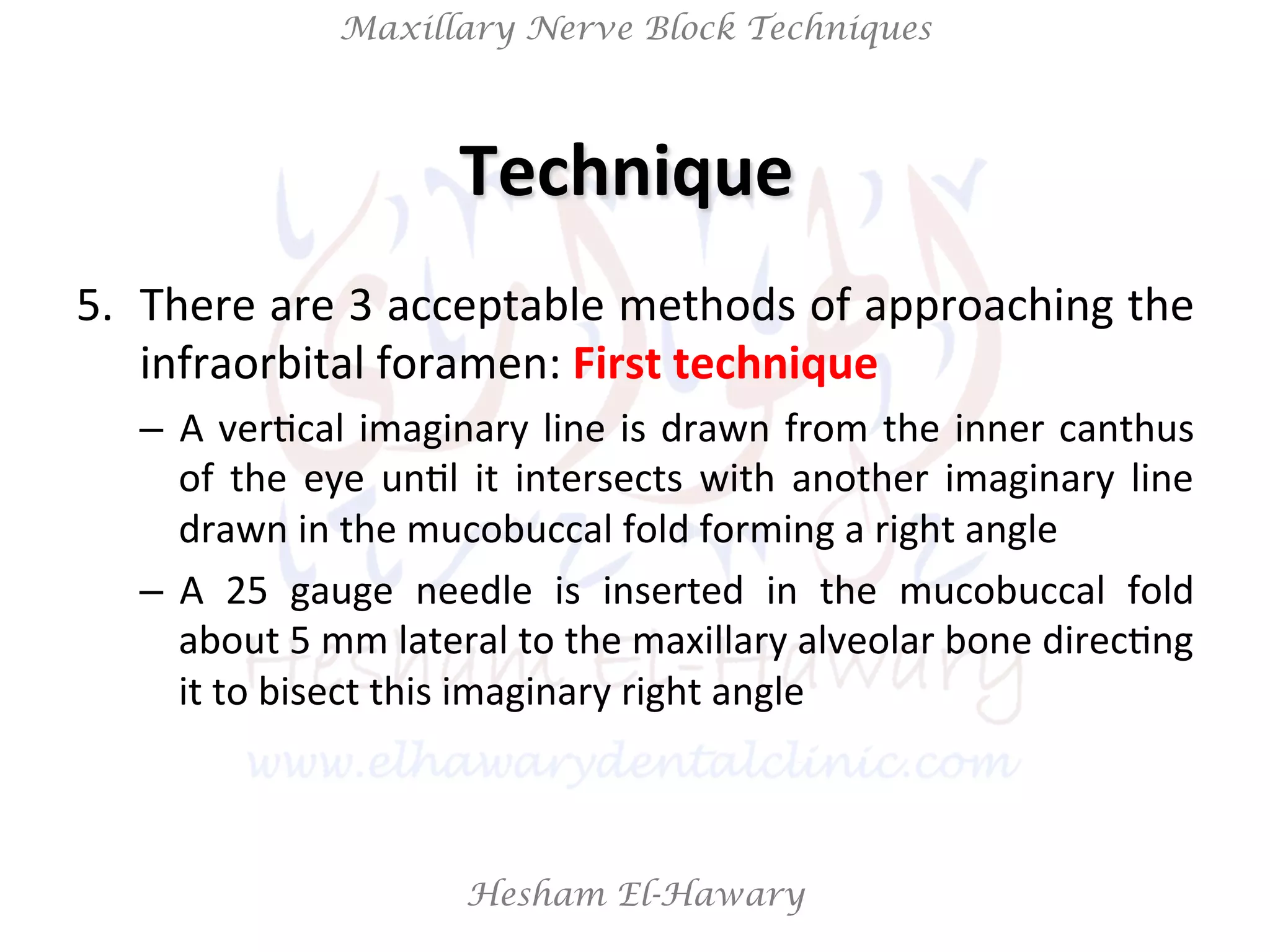 Hesham El-Hawary
Maxillary Nerve Block Techniques
5.  There	
  are	
  3	
  acceptable	
  methods	
  of	
  approaching	
  the	
  
infraorbital	
  foramen:	
  First	
  technique	
  
–  A	
  verNcal	
  imaginary	
  line	
  is	
  drawn	
  from	
  the	
  inner	
  canthus	
  
of	
   the	
   eye	
   unNl	
   it	
   intersects	
   with	
   another	
   imaginary	
   line	
  
drawn	
  in	
  the	
  mucobuccal	
  fold	
  forming	
  a	
  right	
  angle	
  
–  A	
   25	
   gauge	
   needle	
   is	
   inserted	
   in	
   the	
   mucobuccal	
   fold	
  
about	
  5	
  mm	
  lateral	
  to	
  the	
  maxillary	
  alveolar	
  bone	
  direcNng	
  
it	
  to	
  bisect	
  this	
  imaginary	
  right	
  angle	
  
Technique	
  	
  
 