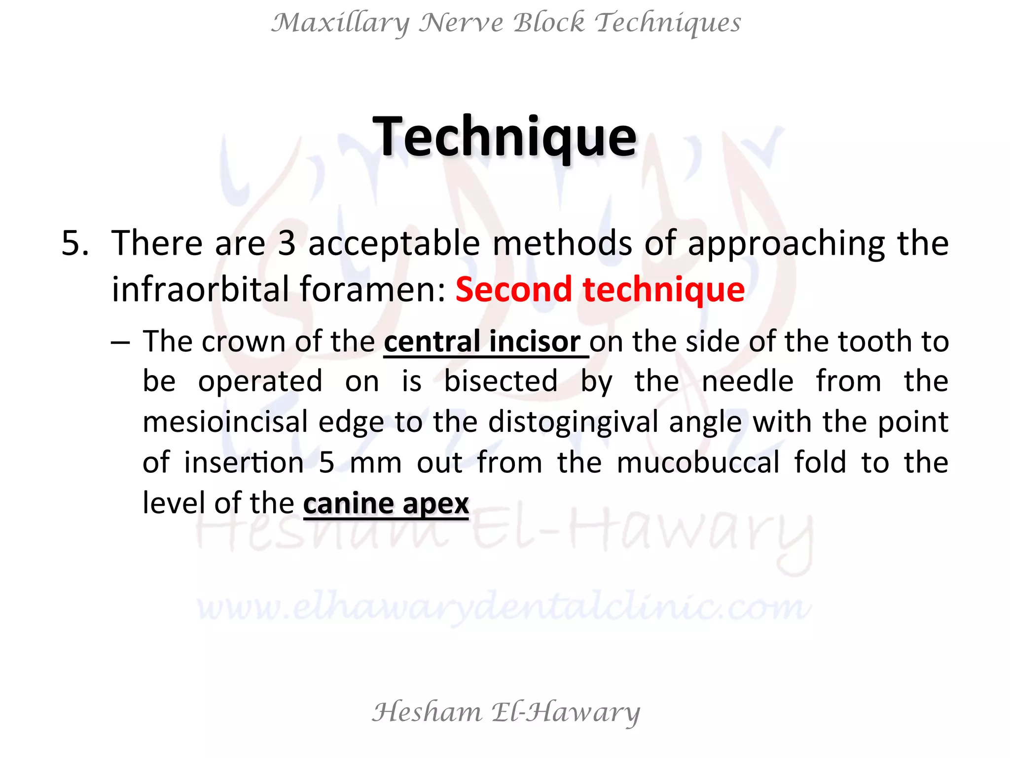Hesham El-Hawary
Maxillary Nerve Block Techniques
5.  There	
  are	
  3	
  acceptable	
  methods	
  of	
  approaching	
  the	
  
infraorbital	
  foramen:	
  Second	
  technique	
  
–  The	
  crown	
  of	
  the	
  central	
  incisor	
  on	
  the	
  side	
  of	
  the	
  tooth	
  to	
  
be	
   operated	
   on	
   is	
   bisected	
   by	
   the	
   needle	
   from	
   the	
  
mesioincisal	
  edge	
  to	
  the	
  distogingival	
  angle	
  with	
  the	
  point	
  
of	
   inserNon	
   5	
   mm	
   out	
   from	
   the	
   mucobuccal	
   fold	
   to	
   the	
  
level	
  of	
  the	
  canine	
  apex	
  
Technique	
  
 
