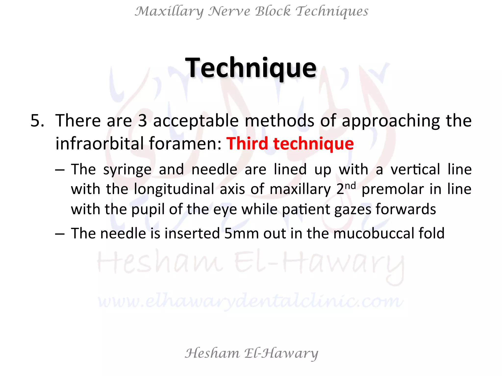 Hesham El-Hawary
Maxillary Nerve Block Techniques
5.  There	
  are	
  3	
  acceptable	
  methods	
  of	
  approaching	
  the	
  
infraorbital	
  foramen:	
  Third	
  technique	
  
–  The	
   syringe	
   and	
   needle	
   are	
   lined	
   up	
   with	
   a	
   verNcal	
   line	
  
with	
  the	
  longitudinal	
  axis	
  of	
  maxillary	
  2nd	
  premolar	
  in	
  line	
  
with	
  the	
  pupil	
  of	
  the	
  eye	
  while	
  paNent	
  gazes	
  forwards	
  
–  The	
  needle	
  is	
  inserted	
  5mm	
  out	
  in	
  the	
  mucobuccal	
  fold	
  
Technique	
  
 