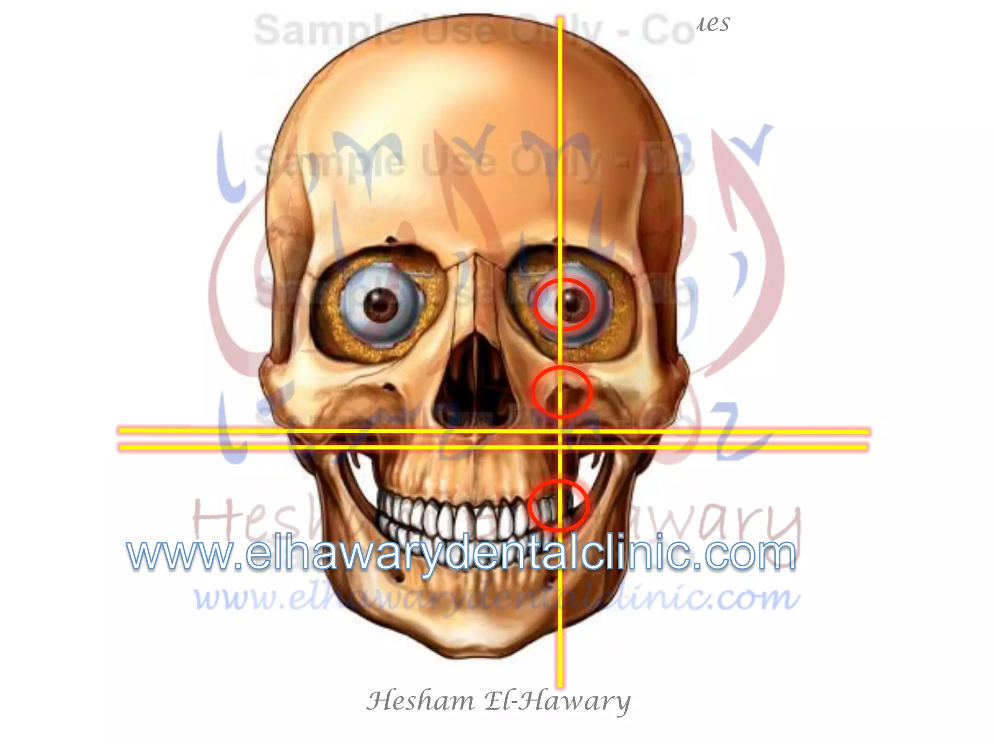 Hesham El-Hawary
Maxillary Nerve Block Techniques
 