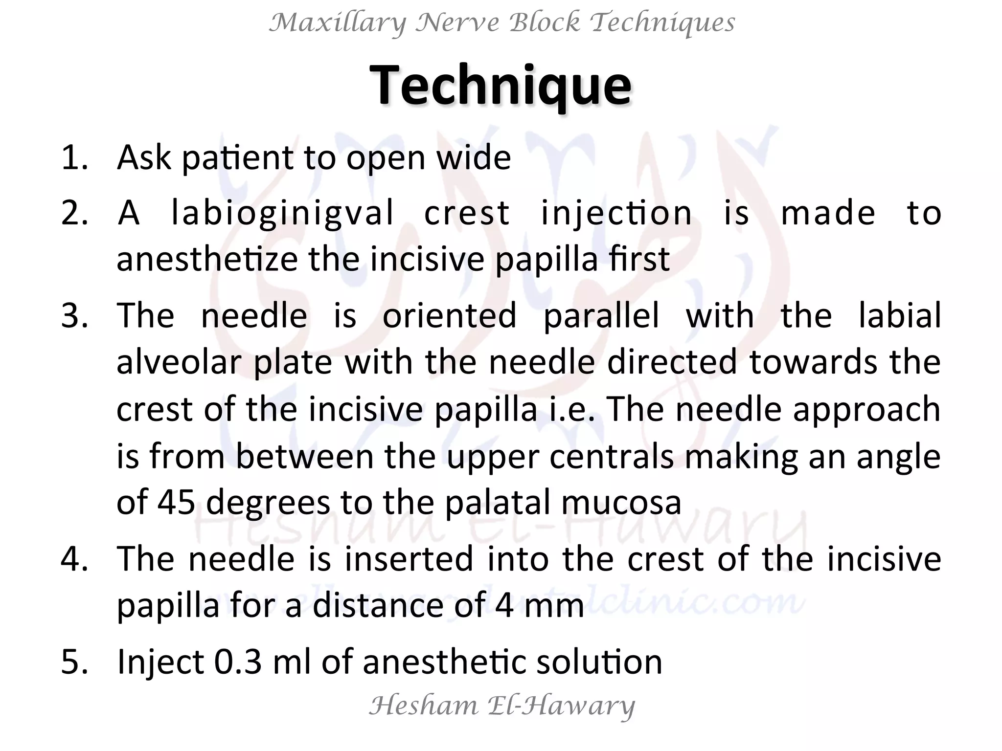 Hesham El-Hawary
Maxillary Nerve Block Techniques
1.  Ask	
  paNent	
  to	
  open	
  wide	
  
2.  A	
   labioginigval	
   crest	
   injecNon	
   is	
   made	
   to	
  
anestheNze	
  the	
  incisive	
  papilla	
  ﬁrst	
  
3.  The	
   needle	
   is	
   oriented	
   parallel	
   with	
   the	
   labial	
  
alveolar	
  plate	
  with	
  the	
  needle	
  directed	
  towards	
  the	
  
crest	
  of	
  the	
  incisive	
  papilla	
  i.e.	
  The	
  needle	
  approach	
  
is	
  from	
  between	
  the	
  upper	
  centrals	
  making	
  an	
  angle	
  
of	
  45	
  degrees	
  to	
  the	
  palatal	
  mucosa	
  
4.  The	
  needle	
  is	
  inserted	
  into	
  the	
  crest	
  of	
  the	
  incisive	
  
papilla	
  for	
  a	
  distance	
  of	
  4	
  mm	
  
5.  Inject	
  0.3	
  ml	
  of	
  anestheNc	
  soluNon	
  	
  
Technique	
  
 