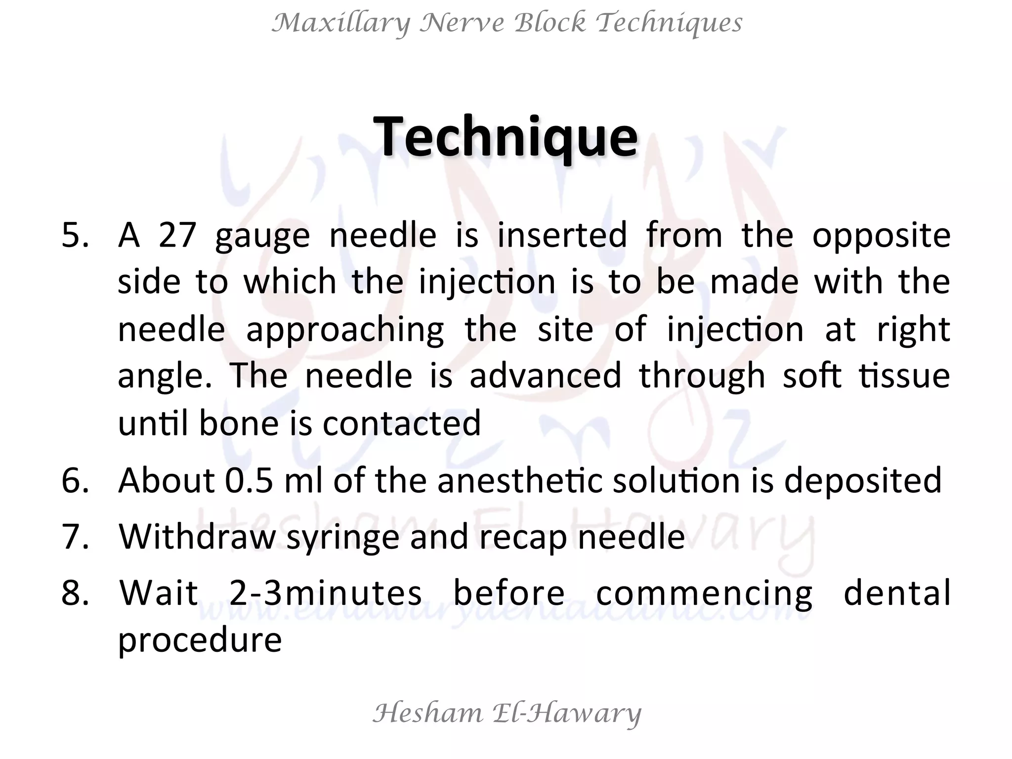 Hesham El-Hawary
Maxillary Nerve Block Techniques
5.  A	
   27	
   gauge	
   needle	
   is	
   inserted	
   from	
   the	
   opposite	
  
side	
  to	
  which	
  the	
  injecNon	
  is	
  to	
  be	
  made	
  with	
  the	
  
needle	
   approaching	
   the	
   site	
   of	
   injecNon	
   at	
   right	
  
angle.	
   The	
   needle	
   is	
   advanced	
   through	
   soV	
   Nssue	
  
unNl	
  bone	
  is	
  contacted	
  
6.  About	
  0.5	
  ml	
  of	
  the	
  anestheNc	
  soluNon	
  is	
  deposited	
  
7.  Withdraw	
  syringe	
  and	
  recap	
  needle	
  
8.  Wait	
   2-­‐3minutes	
   before	
   commencing	
   dental	
  
procedure	
  
Technique	
  
 