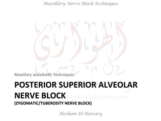 Hesham El-Hawary
Maxillary Nerve Block Techniques
POSTERIOR	
  SUPERIOR	
  ALVEOLAR	
  
NERVE	
  BLOCK	
  
(ZYGOMATIC/TUBEROSITY	
  NERVE	
  BLOCK)	
  
Maxillary	
  anesthe/c	
  Techniques	
  
 