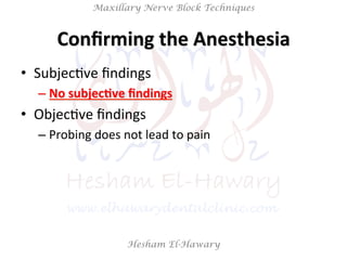 Hesham El-Hawary
Maxillary Nerve Block Techniques
Conﬁrming	
  the	
  Anesthesia	
  
•  SubjecNve	
  ﬁndings	
  
– No	
  subjec/ve	
  ﬁndings	
  
•  ObjecNve	
  ﬁndings	
  	
  
– Probing	
  does	
  not	
  lead	
  to	
  pain	
  
 