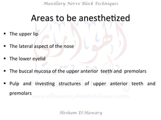 Hesham El-Hawary
Maxillary Nerve Block Techniques
Areas	
  to	
  be	
  anestheNzed	
  
§  The	
  upper	
  lip	
  
§  The	
  lateral	
  aspect	
  of	
  the	
  nose	
  
§  The	
  lower	
  eyelid	
  
§  The	
  buccal	
  mucosa	
  of	
  the	
  upper	
  anterior	
  	
  teeth	
  and	
  	
  premolars	
  
§  Pulp	
   and	
   invesNng	
   structures	
   of	
   upper	
   anterior	
   teeth	
   and	
  
premolars	
  
 