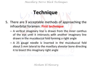 Hesham El-Hawary
Maxillary Nerve Block Techniques
5.  There	
  are	
  3	
  acceptable	
  methods	
  of	
  approaching	
  the	
  
infraorbital	
  foramen:	
  First	
  technique	
  
–  A	
  verNcal	
  imaginary	
  line	
  is	
  drawn	
  from	
  the	
  inner	
  canthus	
  
of	
   the	
   eye	
   unNl	
   it	
   intersects	
   with	
   another	
   imaginary	
   line	
  
drawn	
  in	
  the	
  mucobuccal	
  fold	
  forming	
  a	
  right	
  angle	
  
–  A	
   25	
   gauge	
   needle	
   is	
   inserted	
   in	
   the	
   mucobuccal	
   fold	
  
about	
  5	
  mm	
  lateral	
  to	
  the	
  maxillary	
  alveolar	
  bone	
  direcNng	
  
it	
  to	
  bisect	
  this	
  imaginary	
  right	
  angle	
  
Technique	
  	
  
 