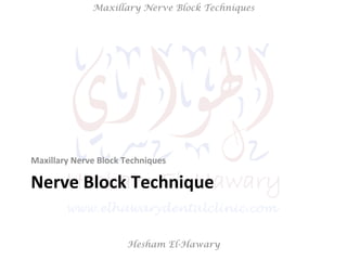 Hesham El-Hawary
Maxillary Nerve Block Techniques
Nerve	
  Block	
  Technique	
  
Maxillary	
  Nerve	
  Block	
  Techniques	
  
 