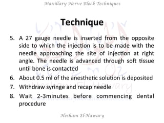 Hesham El-Hawary
Maxillary Nerve Block Techniques
5.  A	
   27	
   gauge	
   needle	
   is	
   inserted	
   from	
   the	
   opposite	
  
side	
  to	
  which	
  the	
  injecNon	
  is	
  to	
  be	
  made	
  with	
  the	
  
needle	
   approaching	
   the	
   site	
   of	
   injecNon	
   at	
   right	
  
angle.	
   The	
   needle	
   is	
   advanced	
   through	
   soV	
   Nssue	
  
unNl	
  bone	
  is	
  contacted	
  
6.  About	
  0.5	
  ml	
  of	
  the	
  anestheNc	
  soluNon	
  is	
  deposited	
  
7.  Withdraw	
  syringe	
  and	
  recap	
  needle	
  
8.  Wait	
   2-­‐3minutes	
   before	
   commencing	
   dental	
  
procedure	
  
Technique	
  
 