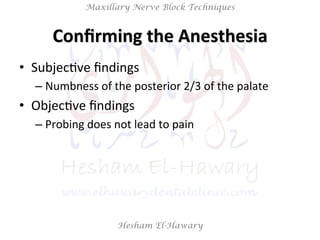 Hesham El-Hawary
Maxillary Nerve Block Techniques
Conﬁrming	
  the	
  Anesthesia	
  
•  SubjecNve	
  ﬁndings	
  
– Numbness	
  of	
  the	
  posterior	
  2/3	
  of	
  the	
  palate	
  
•  ObjecNve	
  ﬁndings	
  	
  
– Probing	
  does	
  not	
  lead	
  to	
  pain	
  
 