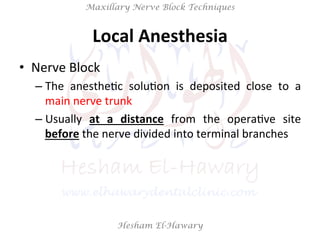 Hesham El-Hawary
Maxillary Nerve Block Techniques
Local	
  Anesthesia	
  
•  Nerve	
  Block	
  
– The	
   anestheNc	
   soluNon	
   is	
   deposited	
   close	
   to	
   a	
  
main	
  nerve	
  trunk	
  	
  
– Usually	
   at	
   a	
   distance	
   from	
   the	
   operaNve	
   site	
  
before	
  the	
  nerve	
  divided	
  into	
  terminal	
  branches	
  
 