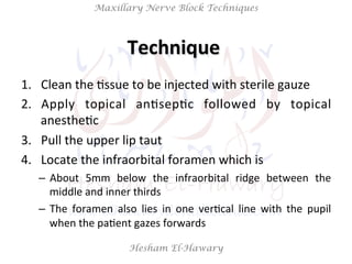 Hesham El-Hawary
Maxillary Nerve Block Techniques
1.  Clean	
  the	
  Nssue	
  to	
  be	
  injected	
  with	
  sterile	
  ...