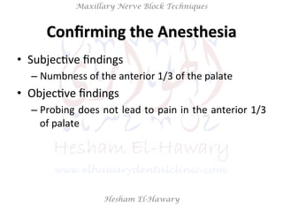 Hesham El-Hawary
Maxillary Nerve Block Techniques
Conﬁrming	
  the	
  Anesthesia	
  
•  SubjecNve	
  ﬁndings	
  
– Numbnes...
