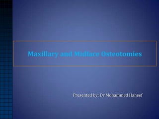 Maxillary and Midface Osteotomies

Presented by: Dr Mohammed Haneef

 