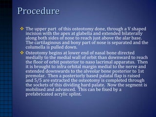 Maxillary Orthognathic surgery | PPTX
