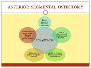ADVANTAGES
Direct
access to
the nasal
structures
Ease of
placement of
rigid internal
fixation.
Ability to remove
bone under direct
visualization
Unhampered
access to superior
maxilla
Preservation of
blood supply
through
excellent
palatal pedicle
ANTERIOR SEGMENTAL OSTEOTOMY
 