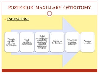 POSTERIOR MAXILLARY OSTEOTOMY
 INDICATIONS
Posterior
maxillary
alveolar
hyperplasia
Total
maxillary
hyperplasia
Distal
repositioning
to guide the
eruption of
impacted
canine and
bicuspids
Spacing in
the dentition
Transverse
excess or
deficiency
Posterior
open bite
 