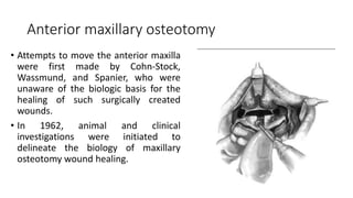 Anterior maxillary osteotomy
• Attempts to move the anterior maxilla
were first made by Cohn-Stock,
Wassmund, and Spanier, who were
unaware of the biologic basis for the
healing of such surgically created
wounds.
• In 1962, animal and clinical
investigations were initiated to
delineate the biology of maxillary
osteotomy wound healing.
 